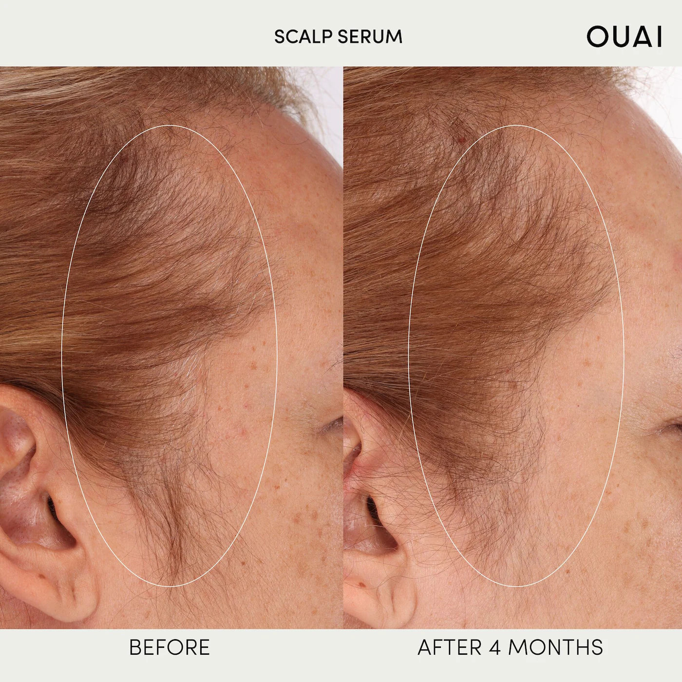 OUAI Hydrating Scalp Serum for Healthy, Fuller Looking Hair *Pre-Orden*